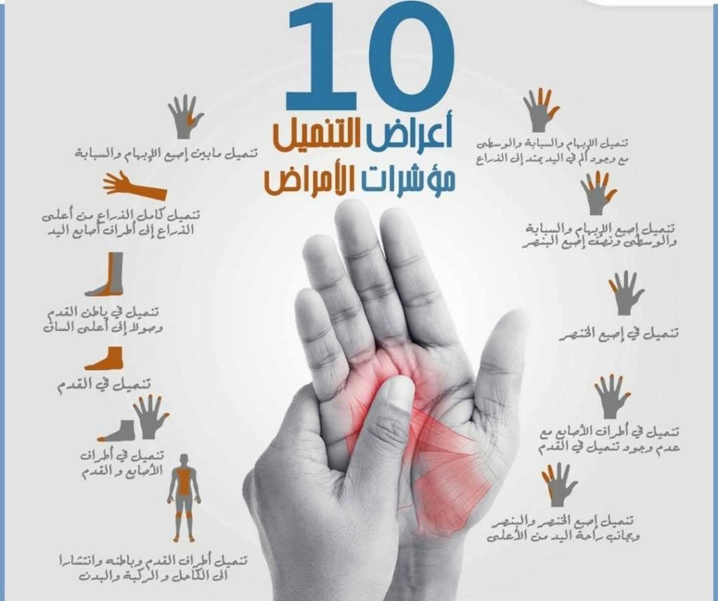 خدمات العلاج الطبيعي